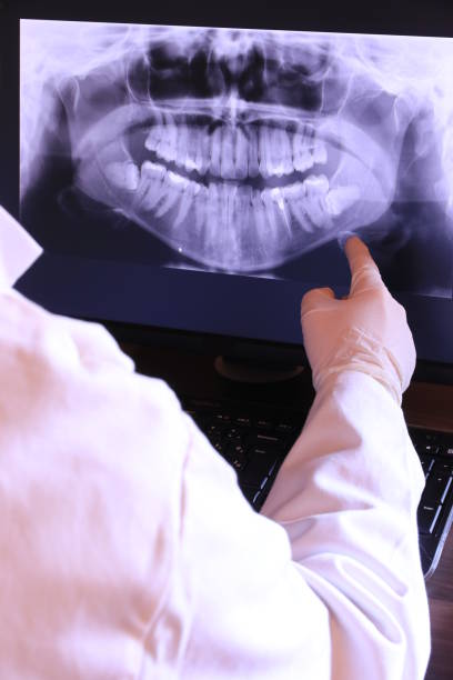 Best Emergency Tooth Extraction in Lakeland, MN