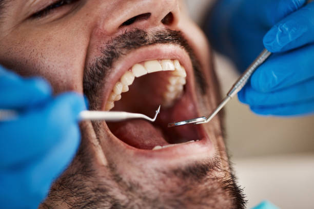 Best Urgent Care for Lost Fillings or Crowns in Lakeland, MN